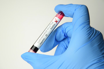Coronavirus blood test positive