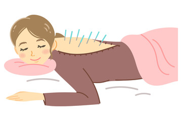 鍼の施術を受ける女性のイラスト