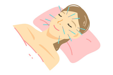 美容鍼の施術を受ける女性のイラスト
