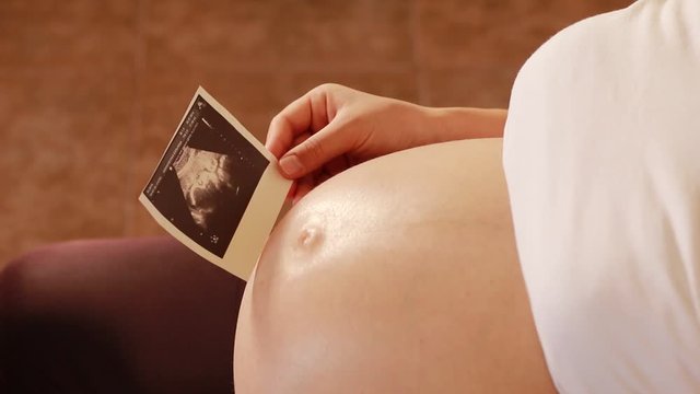 Pregnant woman looks at ultrasound scan of baby