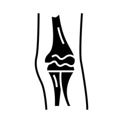 Diarthroses structure black icon, concept illustration, vector flat symbol, glyph sign.