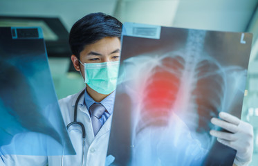 Corona virus infection detected. Doctor checking examining viral infection or pneumonia lesion on Chest X-ray film at hospital.  Coronavirus disease 2019,COVID-19, nCoV 2019 from Wuhan, China.