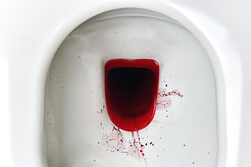 Blood in toilet bowl, Rectal bleeding from hemorrhage, Blood in urine, Health warning sign for...