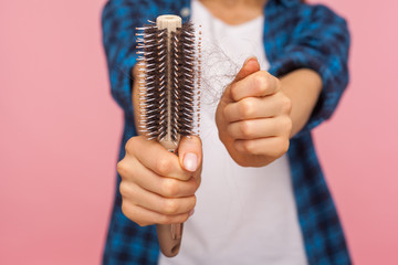 Closeup of girl in casual style clothes showing unhealthy damaged brunette hair on brush, checking...