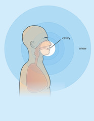 breathing under the avalanche, first aid, snow, cavity, air supply, danger