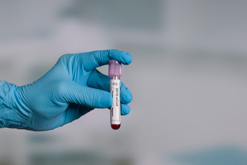 hand in blue glove holding a blood test tube in front of a lab room