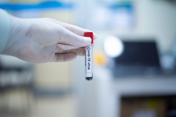 Close up hand hold test-tube of blood.