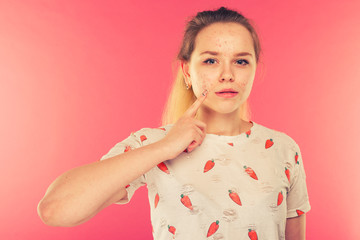 Portrait of teen girl touching her face and looking for acne