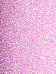 Red blood cells in blood smear, Wright-Giemsa stain, analyze by microscope, 400x