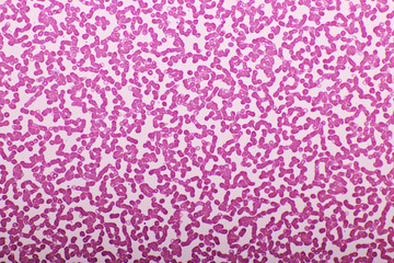 Red blood cells in blood smear, Wright-Giemsa stain, analyze by microscope, 400x