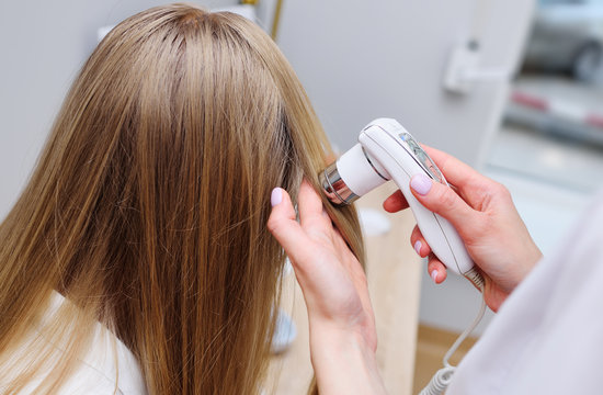 A dermatologist trichologist makes a computer diagnosis of the hair condition of an attractive patient to a young woman. Trichoscopy, trichology, trichoscope, microscope.