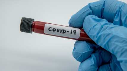 Obraz premium Positive COVID-19 test and laboratory sample blood testing for diagnosis