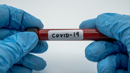 Surgical gloves with a positive coronavirus infected blood sample test.