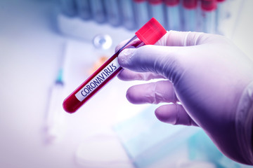 Coronavirus Blood Sample