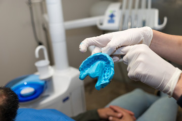 Dentist hands with latex gloves holding dental mold of the patient.