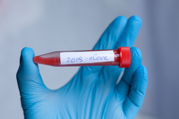 Obraz premium test tube in hand, inscription virus, coronavirus study, virus research