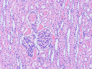 picture of histology human tissue with microscope from laboratory (not Illustration Designation)	