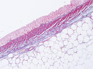 picture of histology human tissue with microscope from laboratory (not Illustration Designation)	