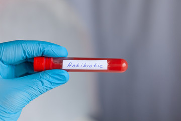 test tube in hand, inscription antibiotic, coronavirus study, virus research