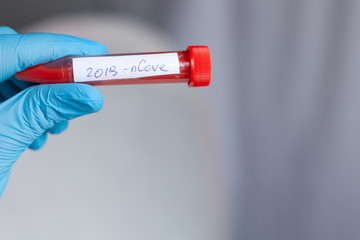 Obraz premium test tube in hand, inscription virus, coronavirus study, virus research