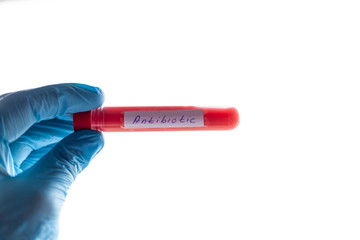 Obraz premium test tube in hand, inscription virus, coronavirus study, virus research