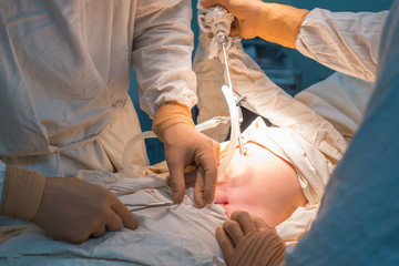 close-up hands of pediatric surgeons perform surgery using laparoscopic ports for endoscopic...
