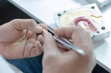 Dental laboratory, acrylic injection and polishing work for dental prostheses