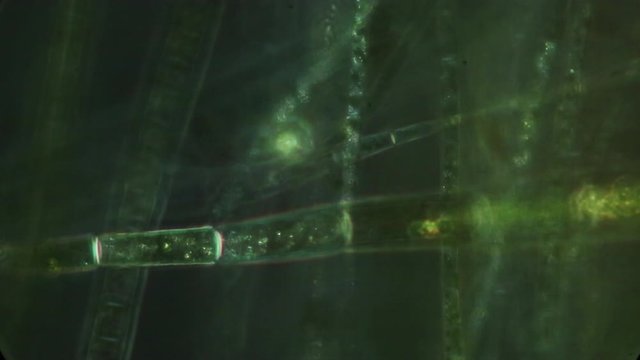 Pyrenoids of chloroplasts glow when observed with polarization microscopy. Here they are seen in the green alga called "Spirogyra."