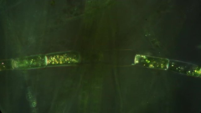 Pyrenoids of chloroplasts glow when observed with polarization microscopy. Here they are seen in the green alga called "Spirogyra."