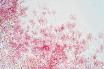 Penicillium fungis  under microscopy for microbiology classroom education.