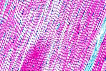 Histological structure of pine stem vascular bundle under microscope.
