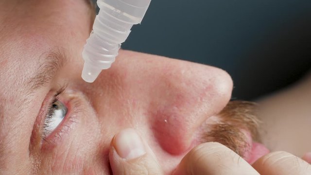 Tired man with bad irritated sore skin dripping eye drops. Glaucoma, cataracts, eye diseases, keratoconjunctivitis, allergies, inflammation, conjunctivitis, fatigue, alcoholism, addiction concept