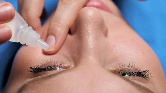 Attractive girl dripping eye drops, introduces them under eyelid into right eye of conjunctival sac, looks up her head thrown back. Glaucoma, cataracts, eye diseases, allergy, conjunctivitis concept