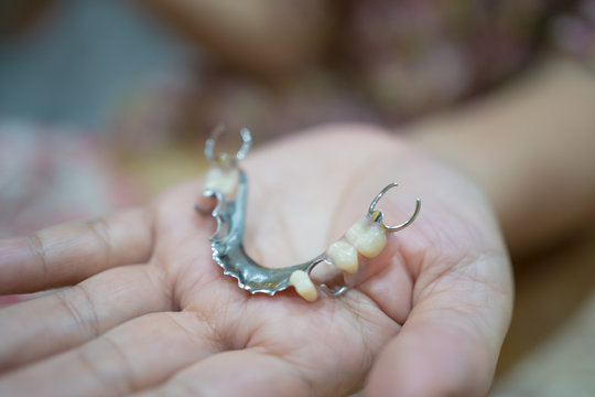 Tooth supported partial denture with metal base in elderly people hand
