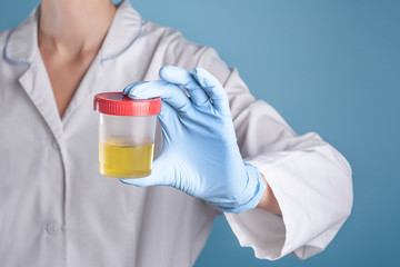 Doctor in white uniform and blue medical gloves holding a container for urine analysis. Urine...