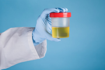 Hand in a blue glove holding medical urine test, on blue background