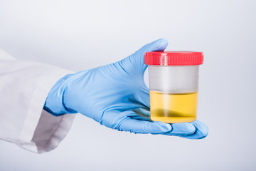 Hand in a blue glove holding medical urine test, on white background