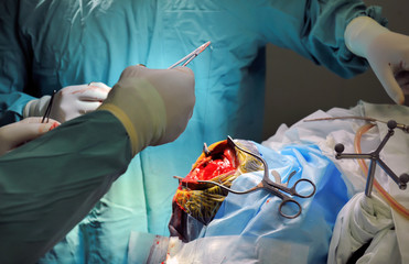 real brain surgery, two surgeons at work, blue toning