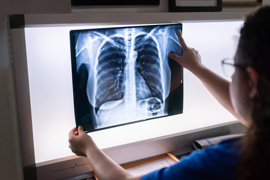 Thoracic x-ray being examined