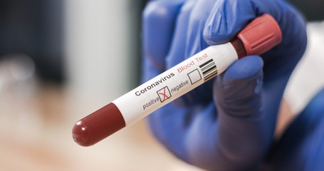 Obraz premium Coronavirus COVID-19 Infected Blood Sample in Doctor Scientist Hands. Epidemic and Virus Outbreak.