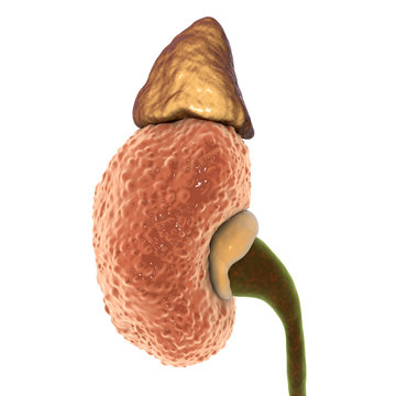 Chronic glomerulonephritis, gross pathology