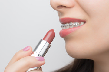 Naklejka premium Red lipstick and teeth with dental braces. Brackets on the teeth after whitening. Self-ligating brackets with metal ties and gray elastics or rubber bands for perfect smile