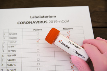 Labolatorium. CORONAVIRUS 2019-nCoV. Wynik pozytywny. - obrazy, fototapety, plakaty