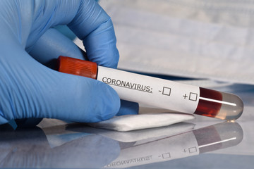 Obraz premium sciences santé virus grippe coronavirus covid-19