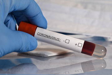 sciences santé virus grippe coronavirus covid-19