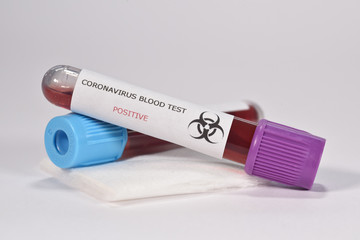 sciences santé virus grippe coronavirus covid-19