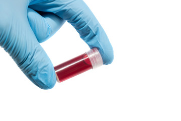 Blood test tube in doctor hand with blue medical gloves.