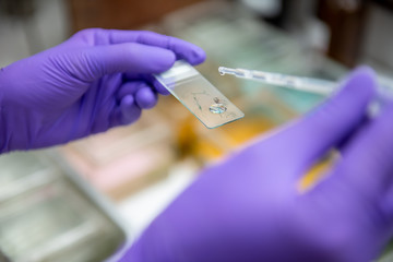 Medical scientists are preparing specimens for cytology to diagnose cell abnormalities.