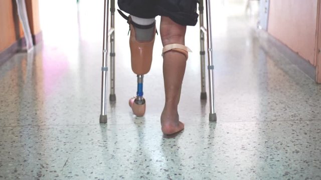 BKA patient walking by prosthesis and waker 