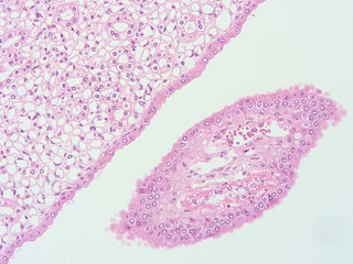 picture of histology human tissue with microscope from laboratory (not Illustration Designation)